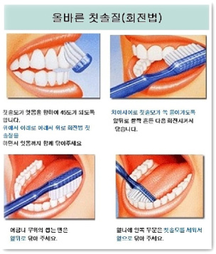 치주질환 생기는 이유와 예방 방법